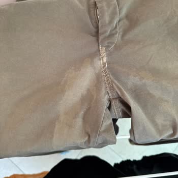 Vanish Oxi Action Pantolonumda Renk Solmasına Sebep Oldu