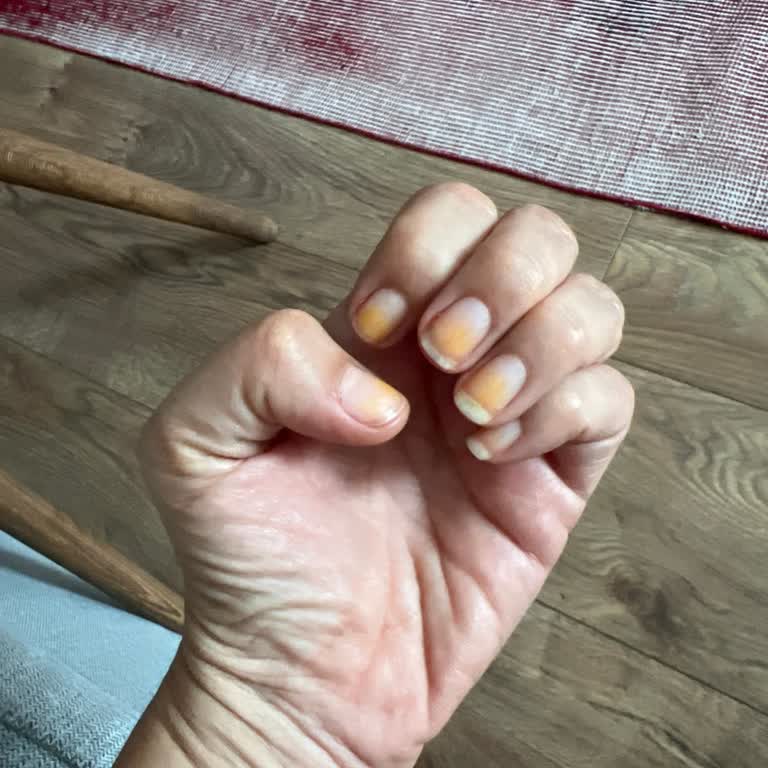 Flormar Oje Tırnakta Leke Bıraktı Açıklama Ve Çözüm Bekliyorum