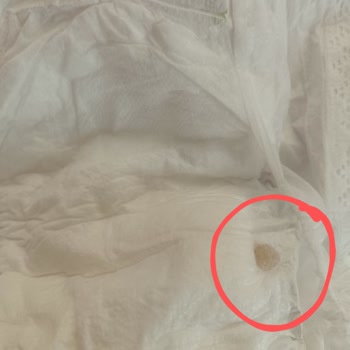 Bebek Bezi İçinde Yapışkan Madde Şoku!