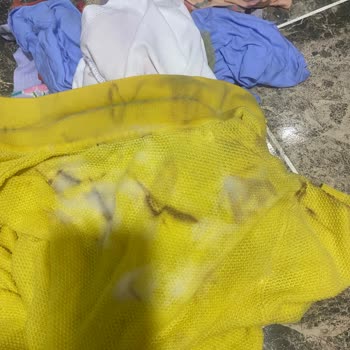 ABC Sıvı Deterjan Kıyafetlerimde Geri Dönüşü Olmayan Lekeler Bıraktı!