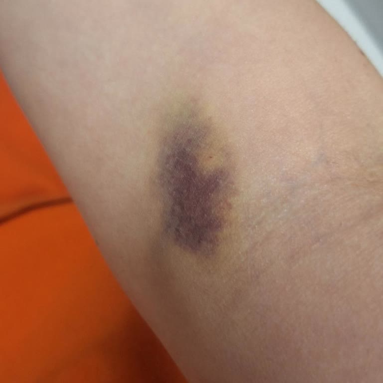 Medical Park Hastanesi Hemşirelerin İlgisiz Ve Sert Davranışı Sonucu Yaşadığım Olumsuz Deneyim