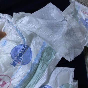 Molfix Premium 5 Numara Bezde Cırt Cırt Bandı Sorunu Ve Kalite Hayal Kırıklığı