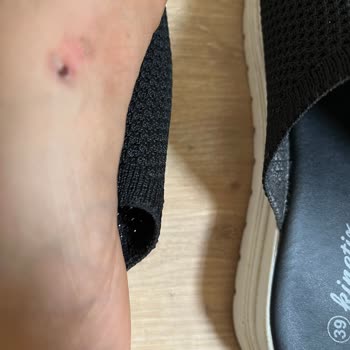 Aldığım Terlik Ayağımı Rahatsız Etti, Çözüm Bekliyorum