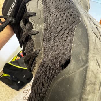 Skechers Ayakkabılar Kısa Sürede Deforme Oldu