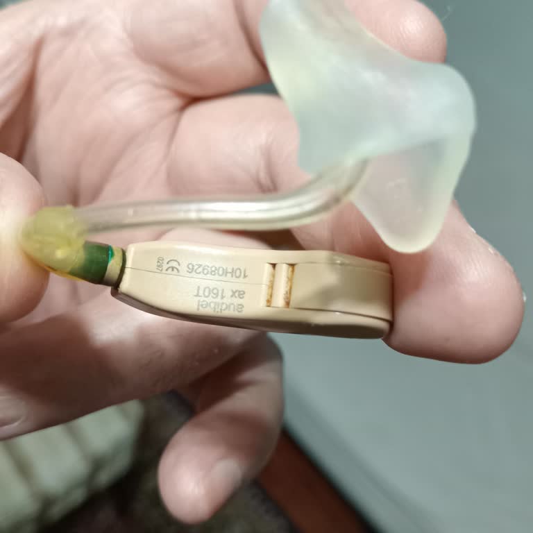 Cihazımın Yedek Parçası Bulunamıyor, Mağduriyet Yaşıyorum