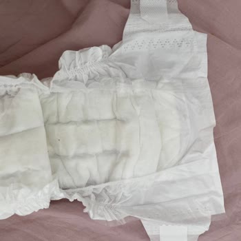 Sleepy Bio Natural Bebek Bezi Kenarları Bebeğimde Alerjiye Sebep Oldu