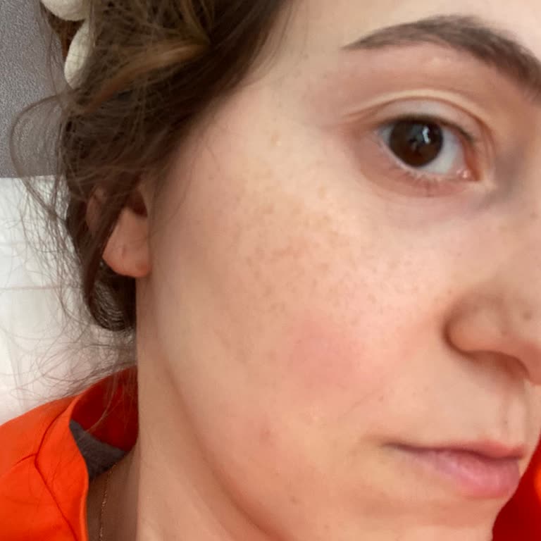 Nivea Gece Bakım Kremi Cildimde Yanma Ve Kızarıklık Yaptı