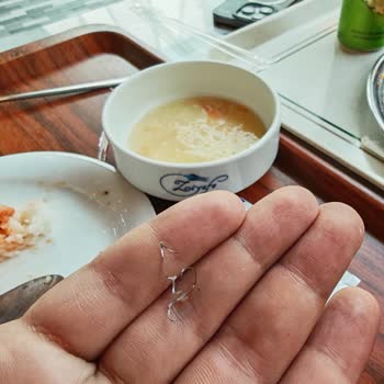 Çorbanın İçinden Tel Parçası Çıkması Ve Personelin İlgisizliği