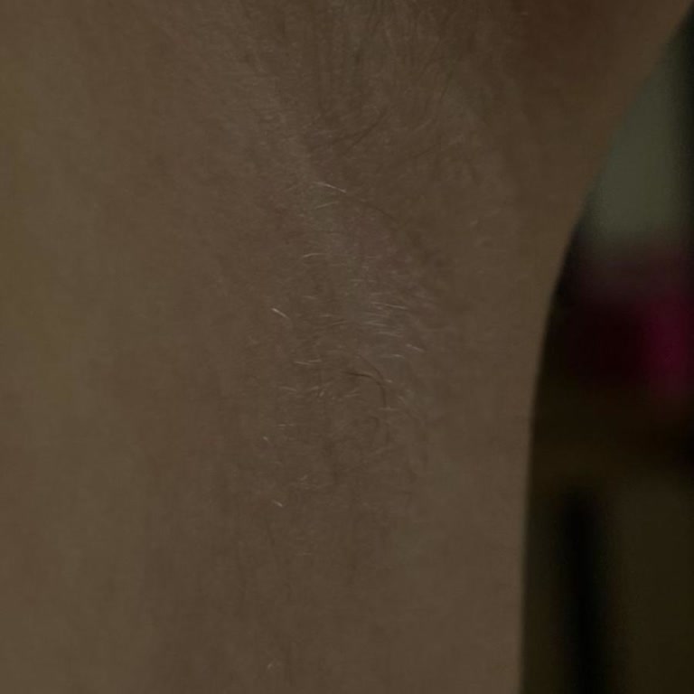 Ecowell Şampuan Sonrası Ciltte Kullanma Oluşumu