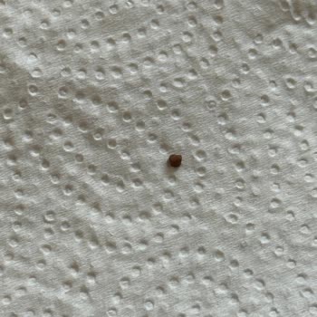 Dondurma İçinden Taş Çıkması Nedeniyle Güven Kaybı Ve Sağlık Riski