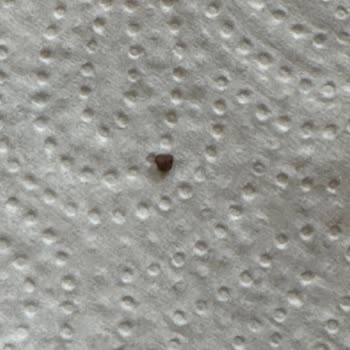 Dondurma İçinden Taş Çıkması Nedeniyle Güven Kaybı Ve Sağlık Riski