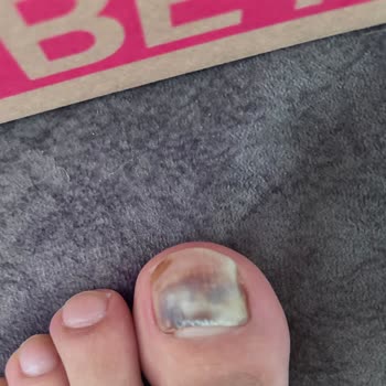 Koray Spor Yanlış Numara Krampon Sağlığımı Tehdit Ediyor, Mağduriyetimin Giderilmesini İstiyorum