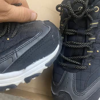 Skechers Ayakkabıda Açılma Sorunu Ve Garanti Desteği Eksikliği