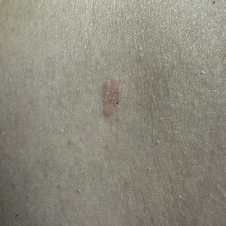 Momordica Aldığım Ürün Sağlık Sorunlarına Yol Açtı