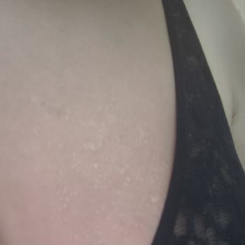 Benri 50+ Faktör Çocuk Güneş Kremi Ciltte Yanık Ve Su Toplamasına Sebep Oldu