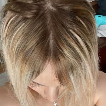 Saç Kaynak Merkezinde Kötü Hizmet Ve Mağduriyet Yaşadım