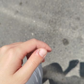 Neşe Oymak Güzellik Merkezi Tırnak İşlemi Sonrası Tırnaklarım Diplerim İltihaplandı