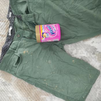 Vanish Toz Ürün Giysilerimi Mahvetti, Mağduriyetimin Giderilmesini İstiyorum