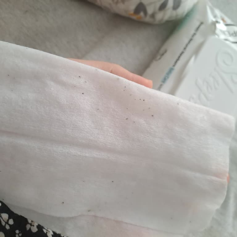 Ebebek'ten Aldığım Islak Mendiller Küflü Ve Kötü Kokulu Çıktı