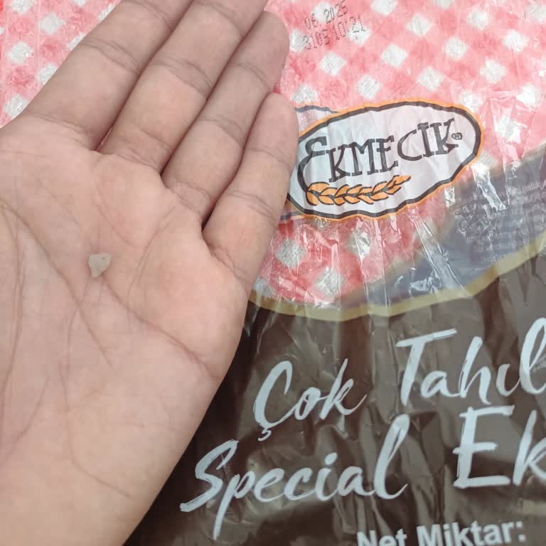 Aldığım Çok Tahıllı Ekmekten Taş Çıktı, Dişim Zarar Gördü