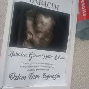Babalar Günü Hediyem Özensiz Gönderildi, İade Talebim Cevapsız Kaldı