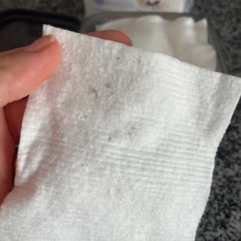 Aldığım Bebek Pamuğundan Çıkan Siyah Maddeler Ve Alerji Sorunu