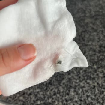 Aldığım Bebek Pamuğundan Çıkan Siyah Maddeler Ve Alerji Sorunu