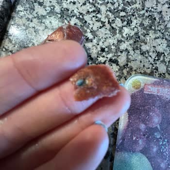 Şahin Sucuklarında Anlaşılmaz Yabancı Cisim Şoku