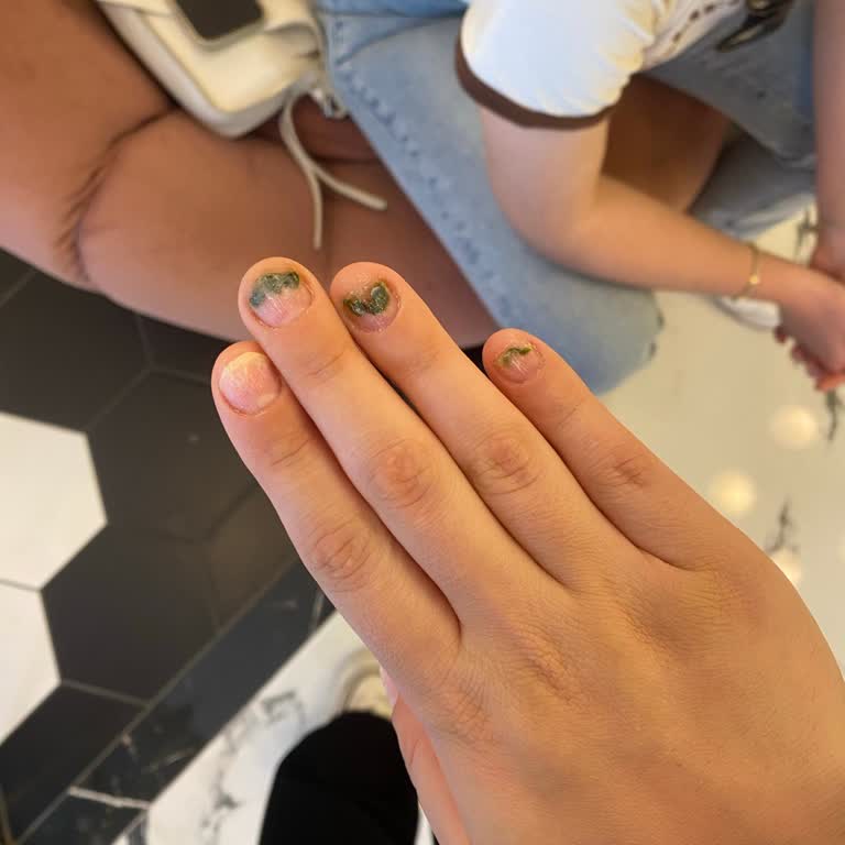 Tırnak Uygulamasında Hijyen Ve Randevu Sorunları Nedeniyle Sağlık Problemi Yaşadım