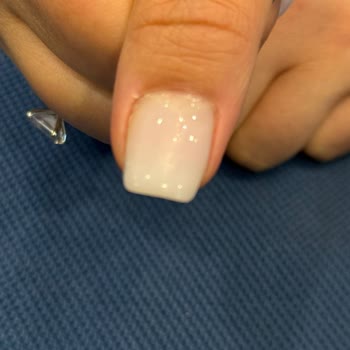 Hijyenik Olmayan Tırnak Uygulaması Ve İlgisiz Davranış