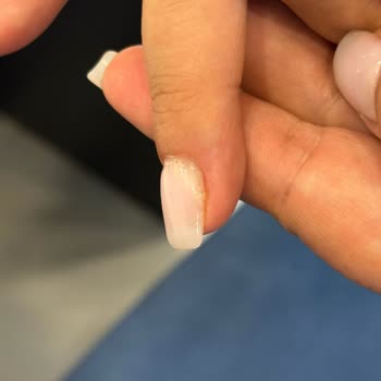 Hijyenik Olmayan Tırnak Uygulaması Ve İlgisiz Davranış