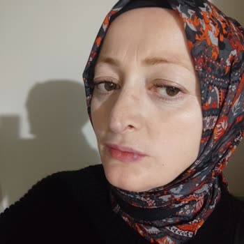 Ray-Ban deja marca en la nariz y no aceptan cambio de gafas