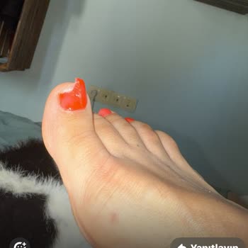 By Meltem Podyum Tırnak, Takılan Tırnak 1 Hafta Sonra Düştü!