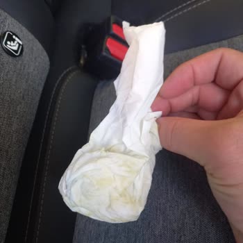 Eyüp Sabri Tuncer Spreylerinde Kronik Sızıntı Ve İlgisiz Müşteri Hizmeti