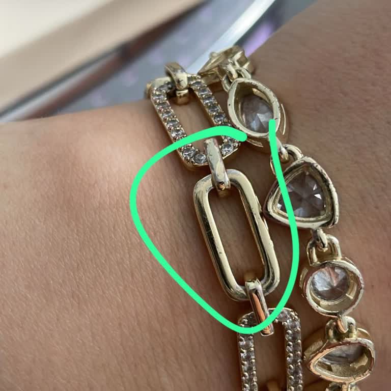 İlk Kullanımda Soyulan Bileklik Hayal Kırıklığı Yarattı