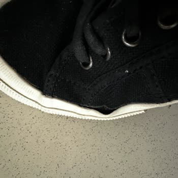 Amazon Ve Superga Arasında Garanti Sorumluluğu Karmaşası: Müşteri Mağduriyeti