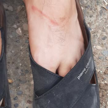 Aldığım Terlikler Ayağımı Yaraladı Mağduriyetim Giderilmiyor