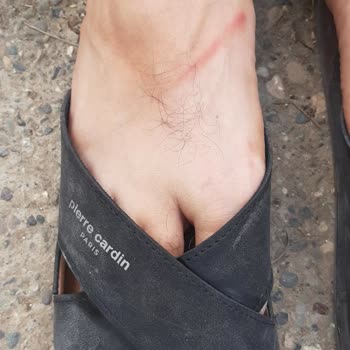 Aldığım Terlikler Ayağımı Yaraladı Mağduriyetim Giderilmiyor