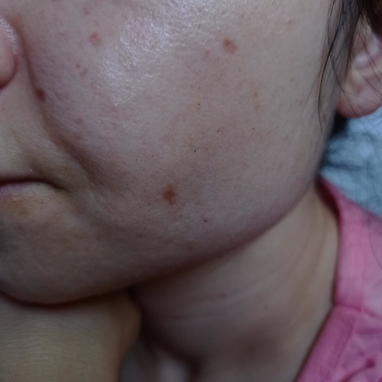 Zeer Lux Beauty Lounge İzler Eski Halinden Daha Kötü Durumda