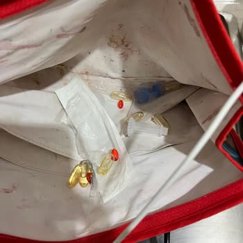 Pamukkale Turizm Valizimize Zarar Verdi Hayati İlaçlarımız Risk Altına Girdi