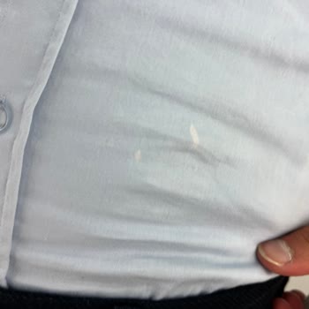 Satın Aldığım Ürünlerde Kusur Ve Yetersiz Kalite Kontrol Nedeniyle Mağduriyet Yaşıyorum