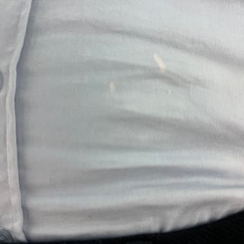 Satın Aldığım Ürünlerde Kusur Ve Yetersiz Kalite Kontrol Nedeniyle Mağduriyet Yaşıyorum