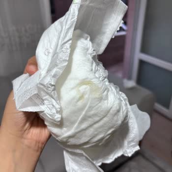 Aldığım Bebek Bezinde Bilinmeyen Cisimle Karşılaştım, Şikayetçiyim