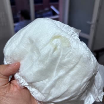 Aldığım Bebek Bezinde Bilinmeyen Cisimle Karşılaştım, Şikayetçiyim