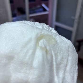 Aldığım Bebek Bezinde Bilinmeyen Cisimle Karşılaştım, Şikayetçiyim