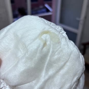 Aldığım Bebek Bezinde Bilinmeyen Cisimle Karşılaştım, Şikayetçiyim