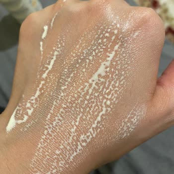 Aldığım Ürün Ciltte Kızarıklık Ve Kaşıntıya Sebep Oldu, Orijinalliği Şüpheli