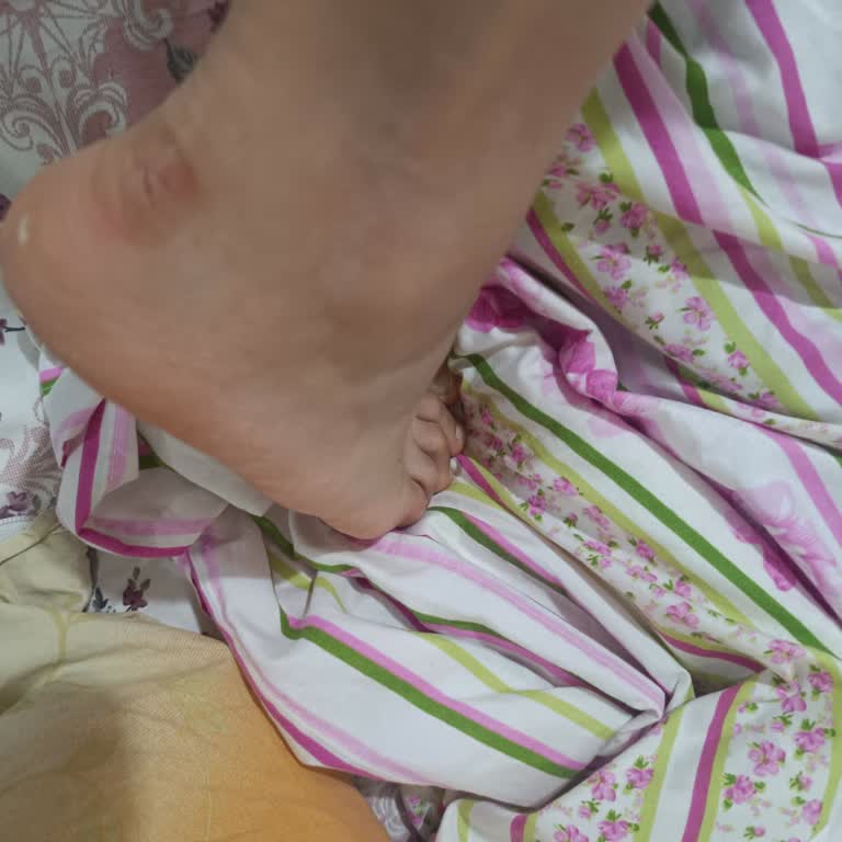 Adidas Ayakkabının Ağırlığı Ve Rahatsızlığı Nedeniyle Yaşadığım Sorun