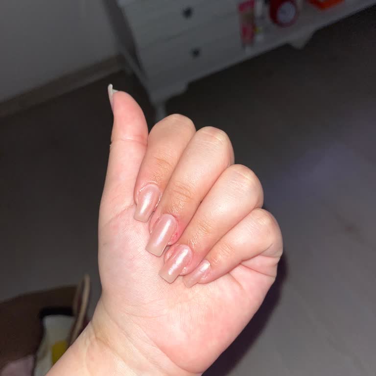 Hijyen Ve Profesyonellikten Uzak, Güven Sarsıcı Bir Deneyim