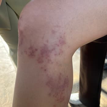 Tiamoo Premium Güzellik Cildimi Yaktılar Kabul Etmiyorlar